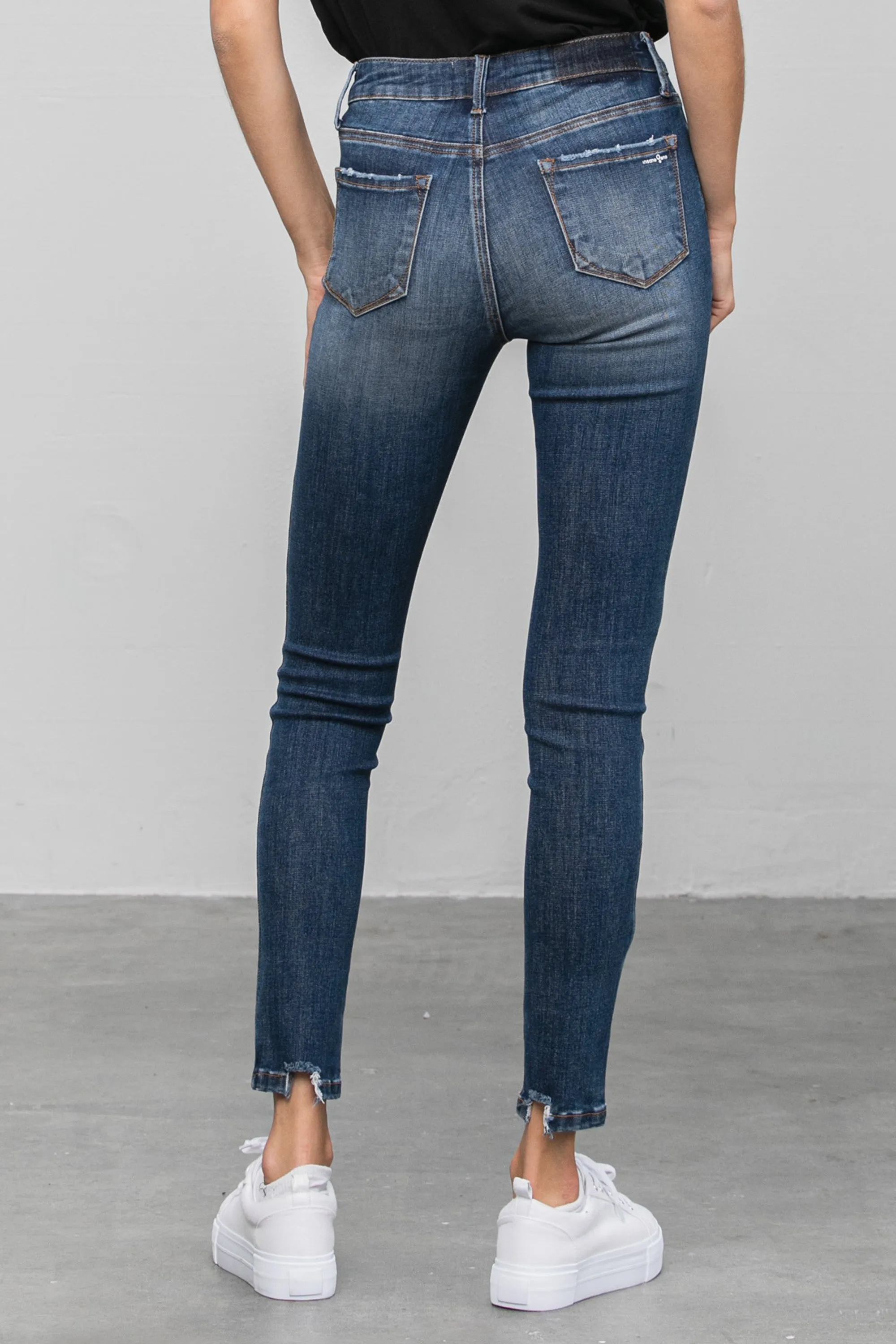 Youknow Ankle Skinny Jeans